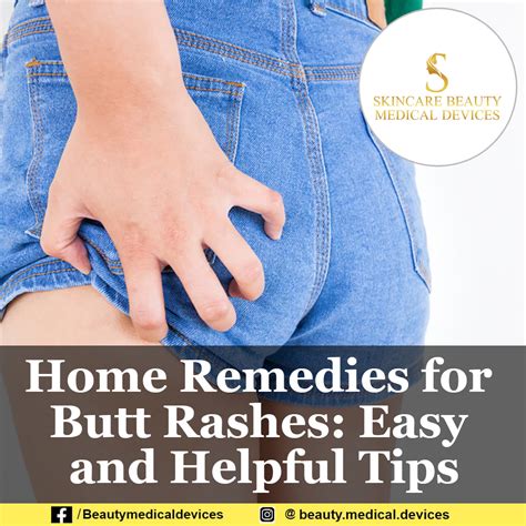 butt spread|Butt Rashes: Causes, Remedies, Treatment, and Pain Relief.